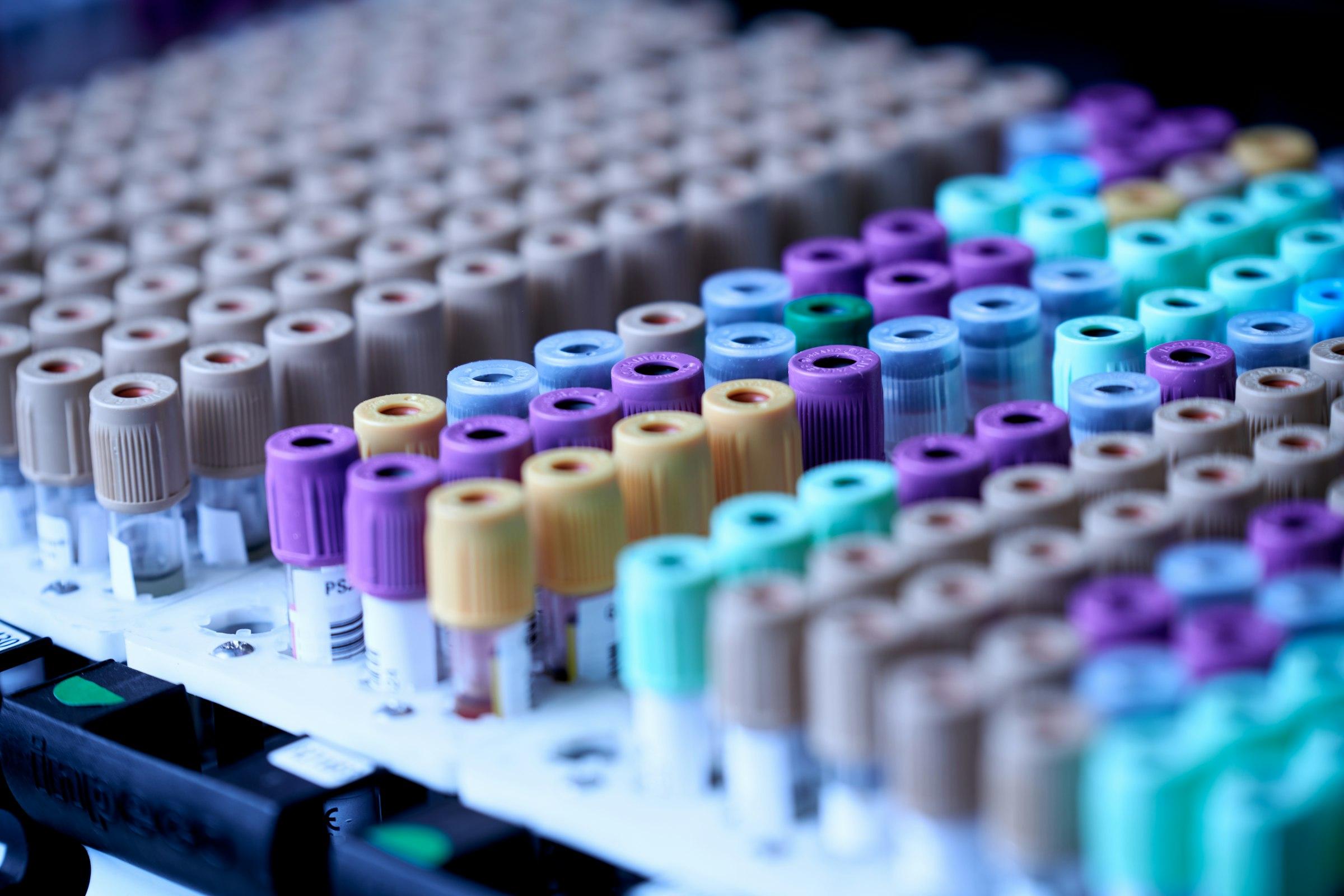 Rows of laboratory sample tubes in a diagnostic rack.