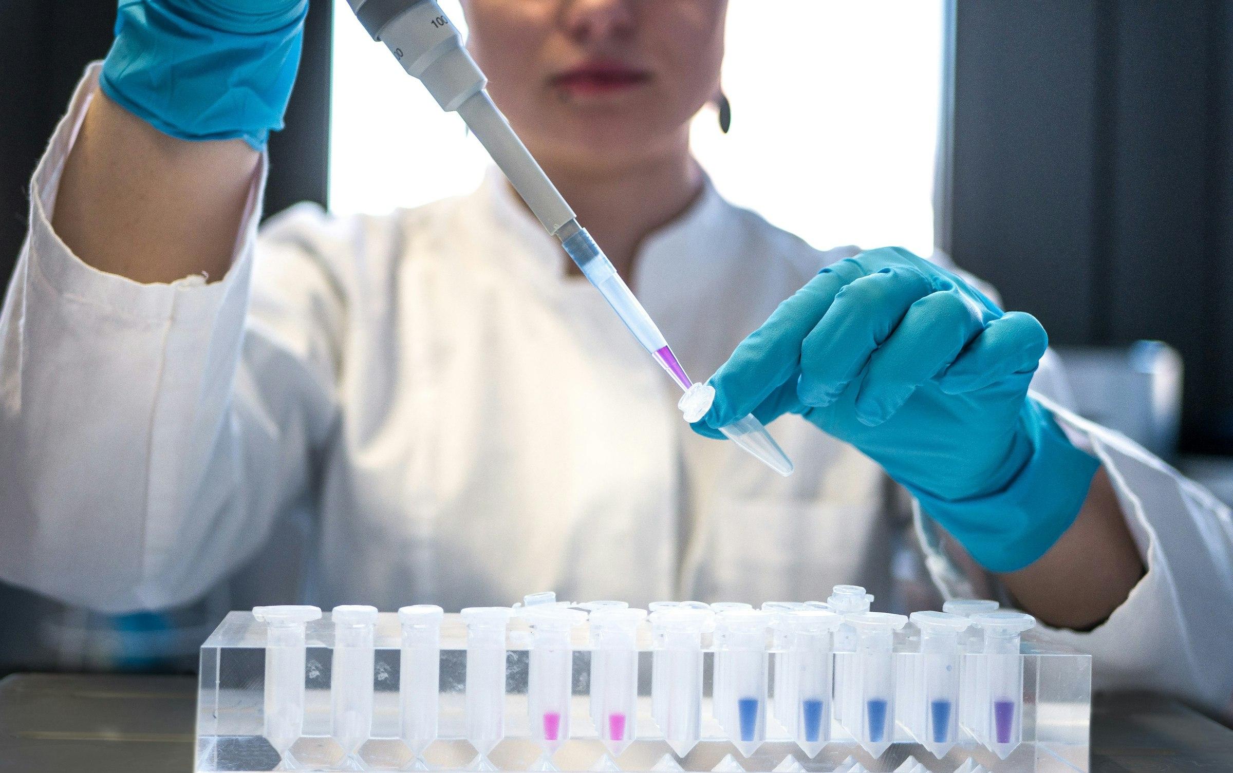 A scientist pipetting samples in a research laboratory.